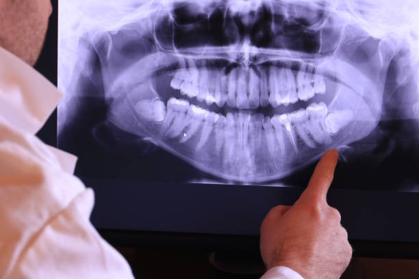 Best Emergency Gum Treatment in New Windsor, MD